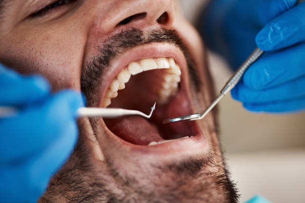 Best Emergency Tooth Extraction in Williamston, SC